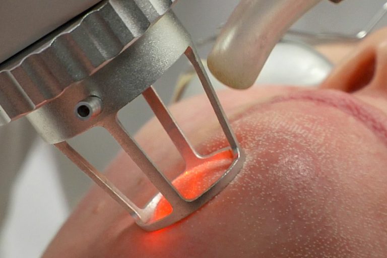 Nordlys Laser Found to Alter DNA Methylation Patterns in Human Skin